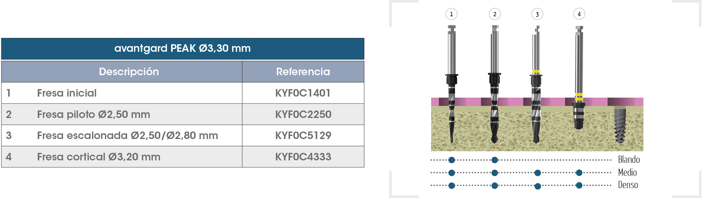 Secuencia Avantgard PEAK 3.30 ES