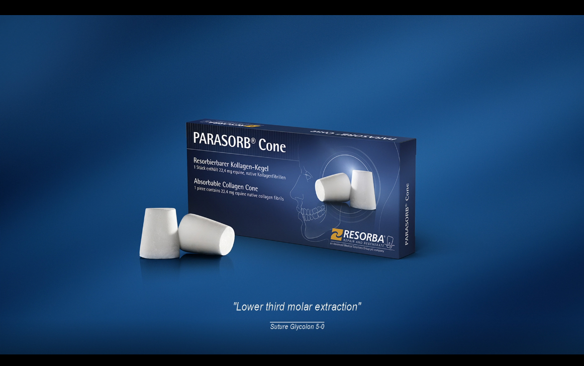Imatge video Parasorb Cone