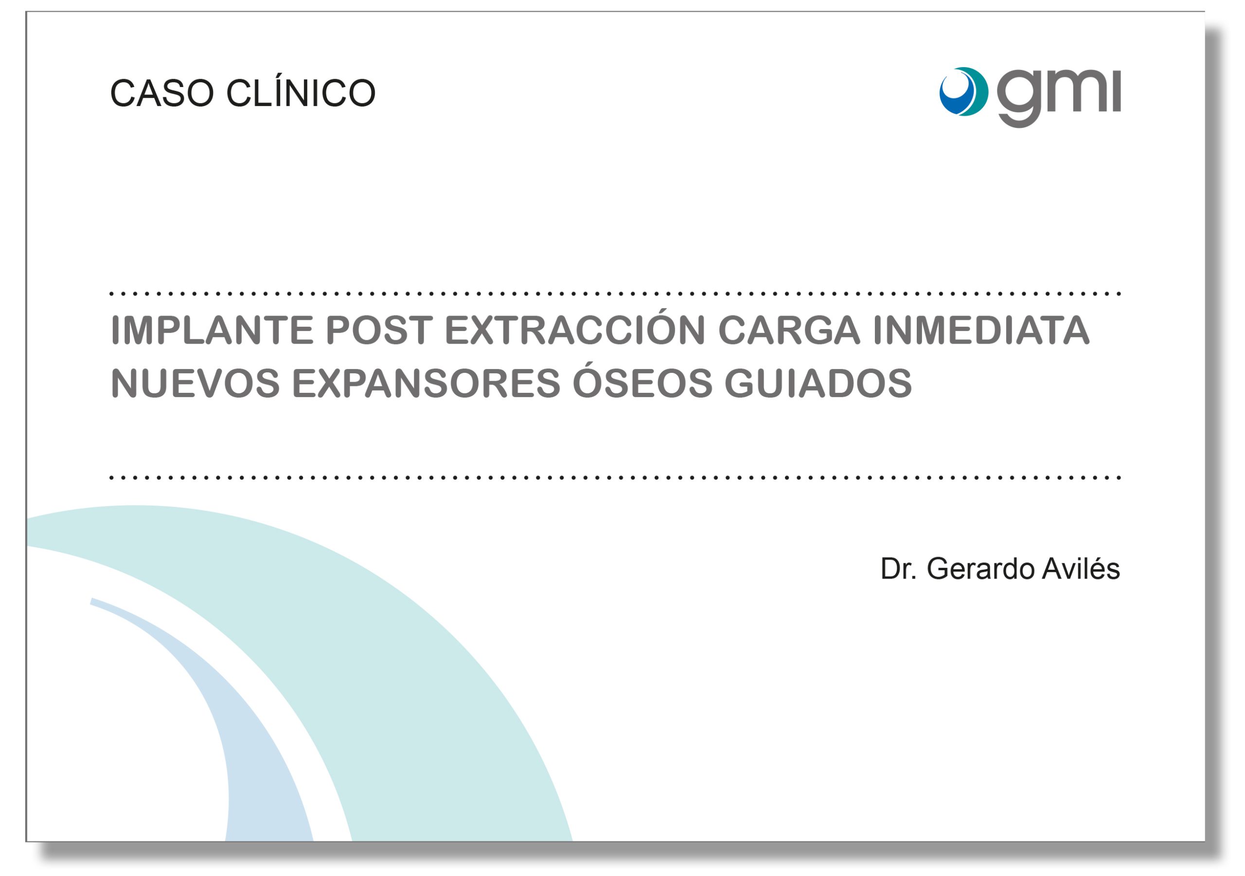 Portada Compactadores